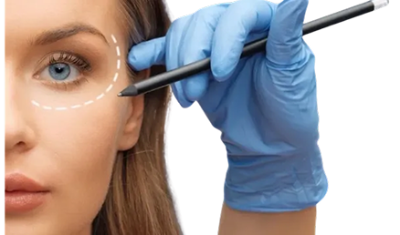 Dermal Filler